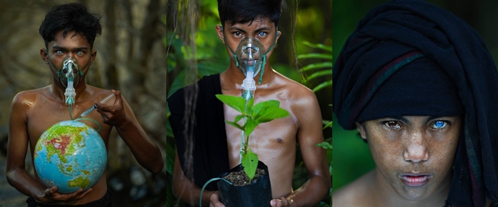 Viral Warga Buton Sultra Bermata Biru, Ternyata Karena Kondisi Genetik Langka Ini-2