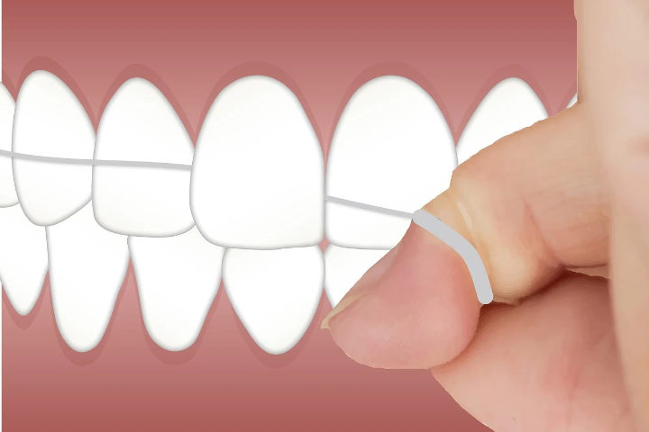 Ajarkan Flossing dan Rinsing