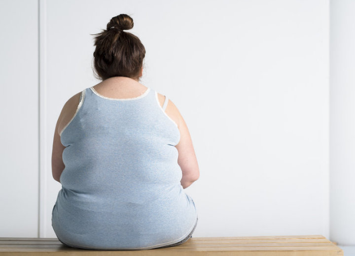 Obesitas