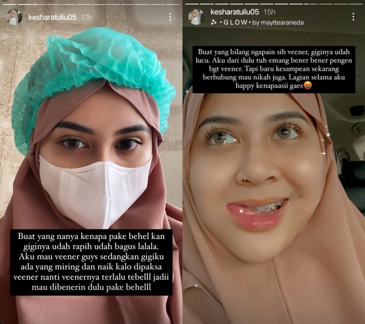 Kesha Ratuliu Kesal Dilarang Larang Veener Gigi Minta Netizen Tak Ikut Campur