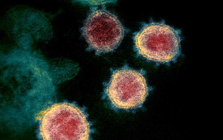 Virus Corona