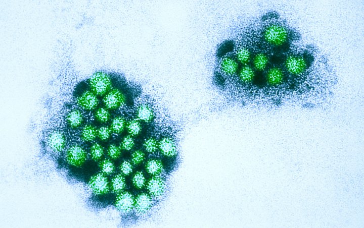 Kemenkes Akui Sudah Deteksi Norovirus di Indonesia Sejak Lama, Gejala Disebut Mirip Diare