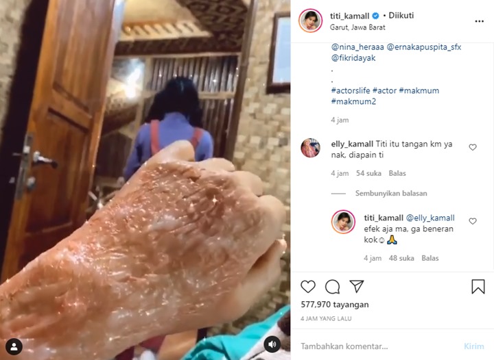 Tangan \'Melepuh\' Titi Kamal Bikin Sang Mama Khawatir, Fitri Tropica Gemes