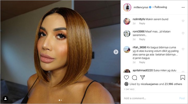 Millendaru Bikin Kecewa Karena Penampilan Terbarunya, Kembali Filler Bibir dan Ganti Gaya Rambut