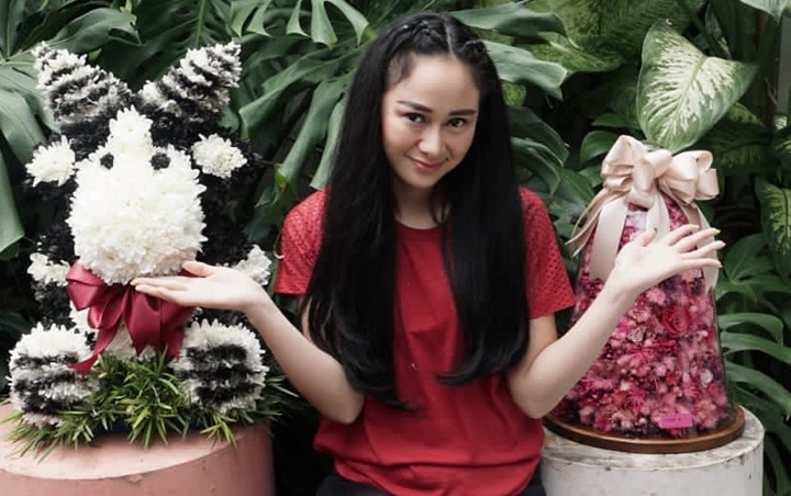 Kecantikan 'Tak Diakui' Netizen, Denise Chariesta Blak-blakan Lakukan Operasi Plastik