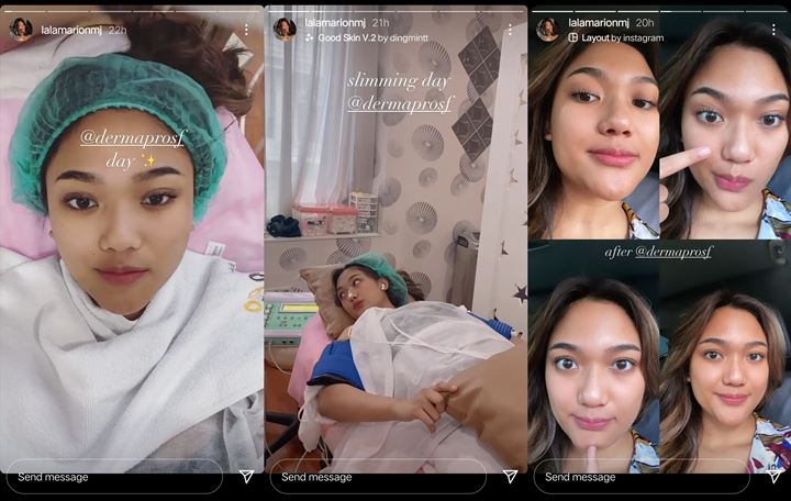 Marion Jola Asik Lakukan Ini Saat Brisia Jodie \'Mantan Sahabat\' Kena Santet Sampai Dituding Gimmick