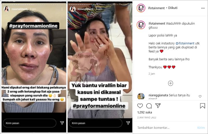 Isa Zega Dipukul Orang Tak Dikenal Hingga Hidung Berdarah, Rosa Meldianti Ungkap Kondisi Terkini
