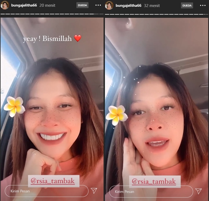 Bagikan Foto USG Calon Bayi Senyum, Bunga Jelitha Jawab Begini Soal Jenis Kelamin