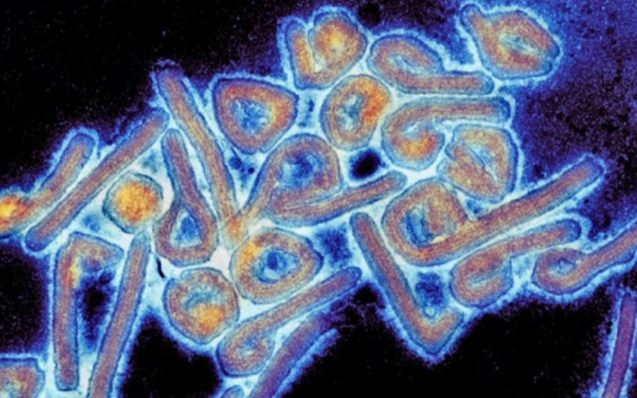 Bisa Menular Antar Manusia, Virus Chapare di Bolovia Berpotensi Jadi Pandemi Baru?