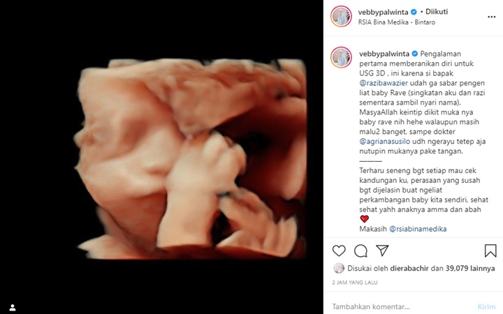 Vebby Palwinta Pamer Foto USG \'Rave\' Malu-malu Tutupi Muka, Cewek atau Cowok?