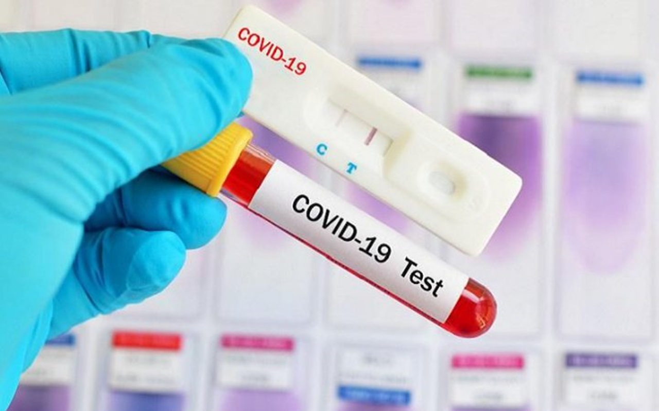WHO Sorot Kesenjangan Jumlah Kasus Suspek dan Testing COVID-19 di Indonesia