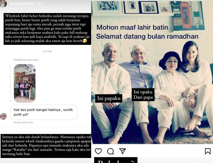 Dituding Suntik Putih, Kesha Ratuliu Buktikan Dirinya Memang Keturunan Bule