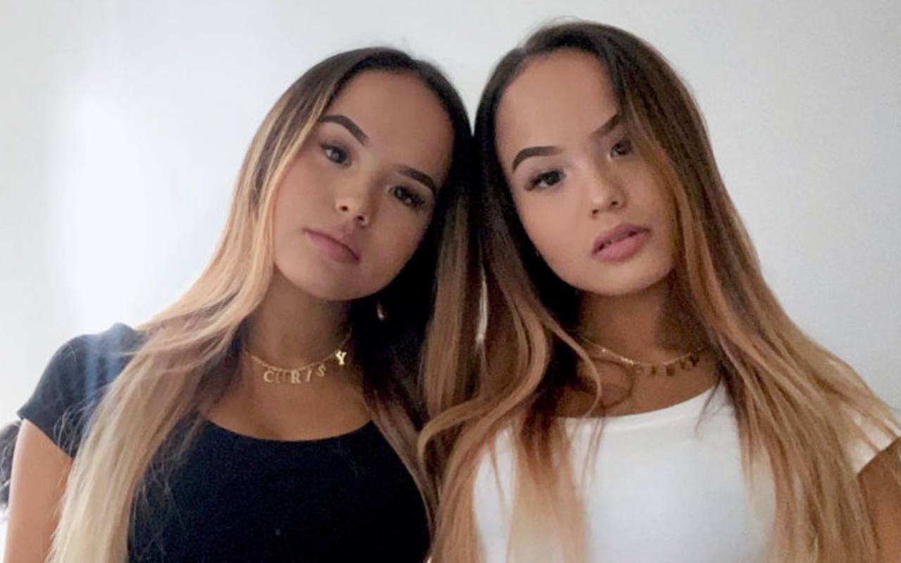 Bibir The Connell Twins Jadi Bahan Gosip, Nama Lucinta Luna Ikut Terseret