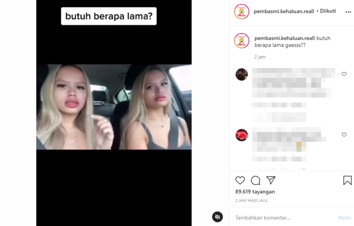 Bibir The Connell Twins Jadi Bahan Gosip, Nama Lucinta Luna Ikut Terseret