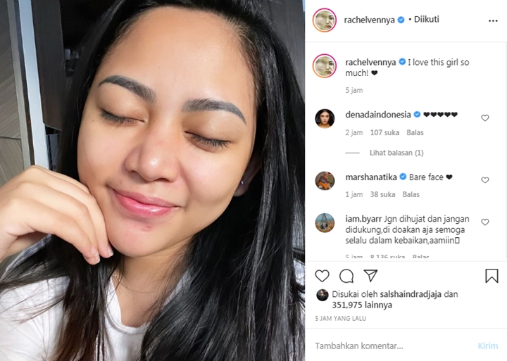Rachel Vennya \'Self Love\' Lewat Potret Cantik Terbaru, Dipuji Mirip Baby Chava Banget