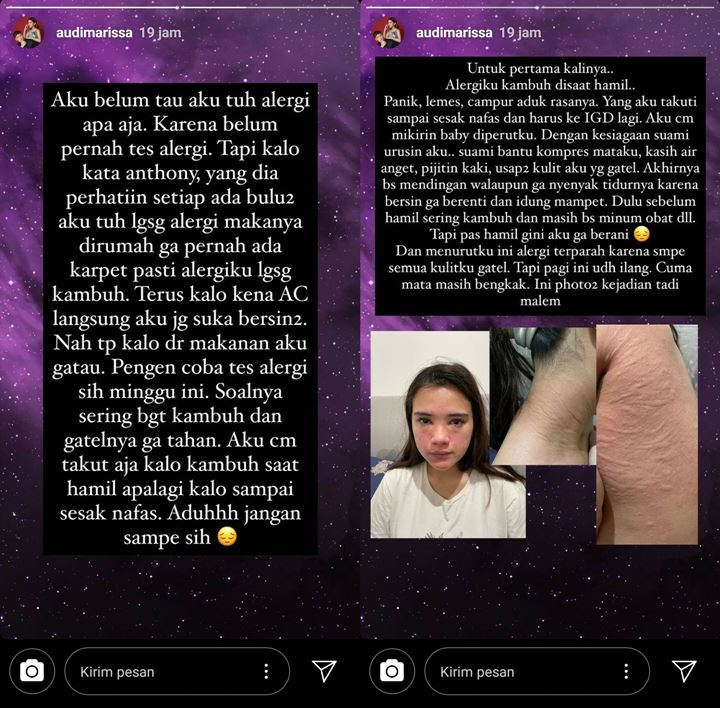 Audi Marissa Alami Muka Bengkak Hingga Sesak Napas Karena Alergi, Cemaskan Kondisi Kandungan