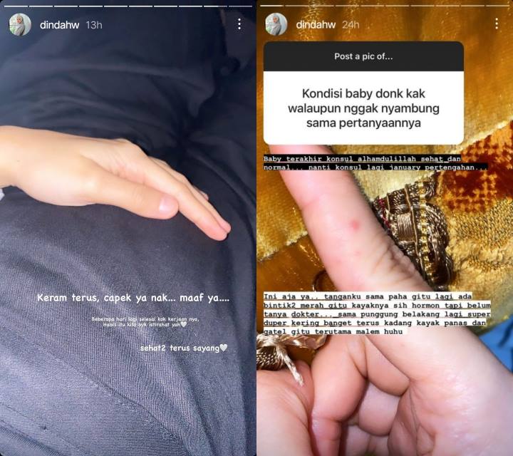 Dinda Hauw \'Bumil\' Ungkap Kondisi Tubuhnya Sering Alami Gejala Ini Setiap Malam