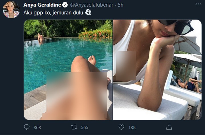 Kondisi Anya Geraldine Usai Jatuh dari Sepeda