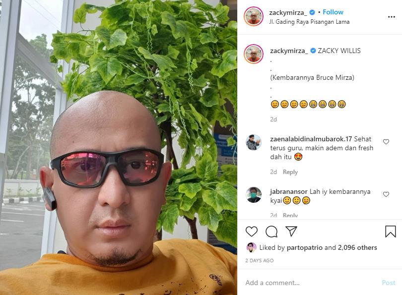 Ustaz Zacky Mirza Botaki Kepala Disebut Mirip Bruce Willis, Ternyata Gara-gara Derita Penyakit Ini