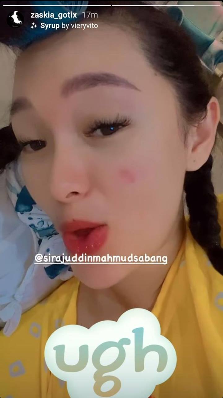 Zaskia Gotik Terpisah dengan Suami Karena Corona, Sampai Muncul Jerawat Rindu