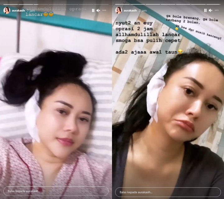 Aura Kasih Lakukan Operasi Di Bagian Telinga, Begini Kondisinya