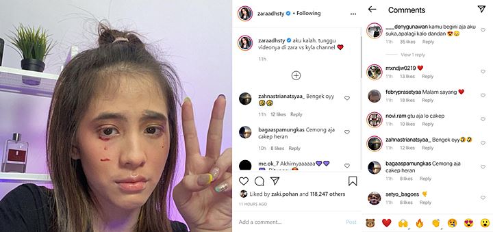 Muka Cemong Adhisty Zara Tetap Bikin Netter Salah Fokus, Tuai Pujian Selangit