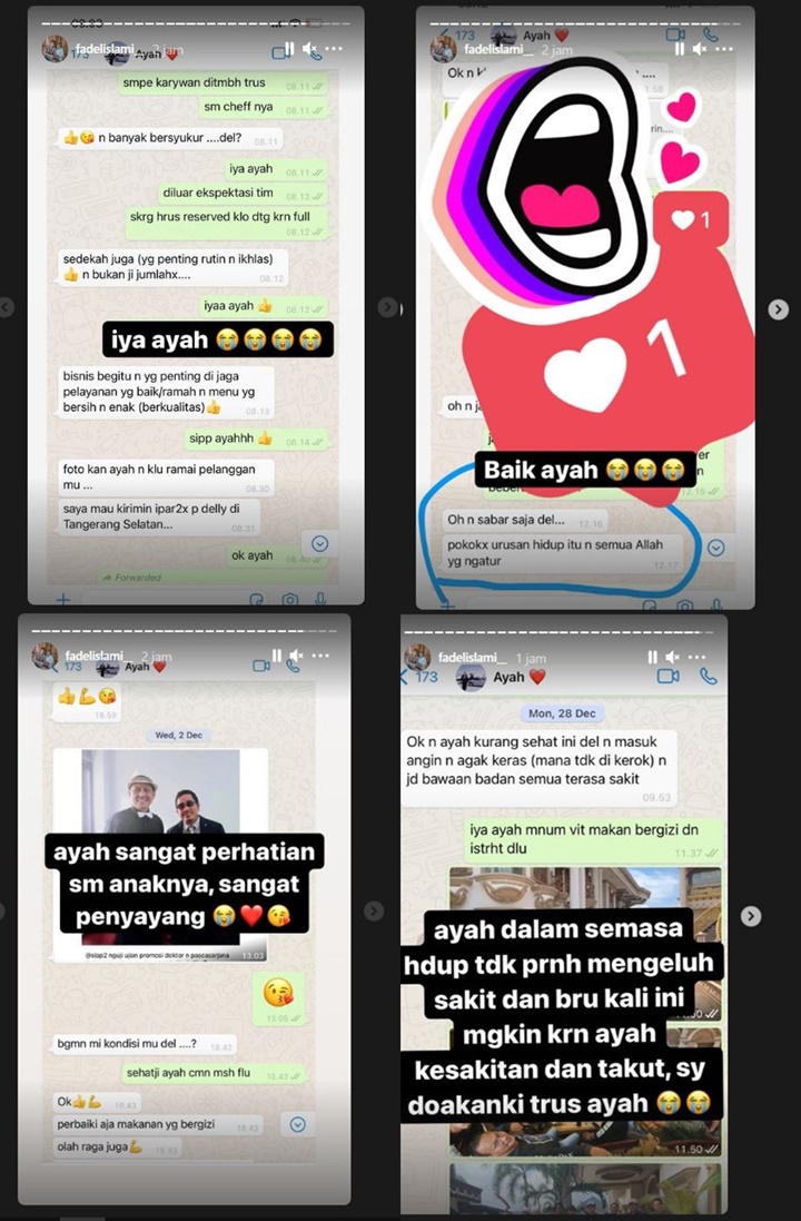 IGStory