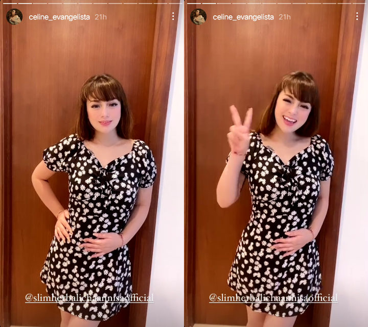 Celine Evangelista Dipuji Mirip Artis Telenovela Gara-gara Rambut Barunya, Setuju?
