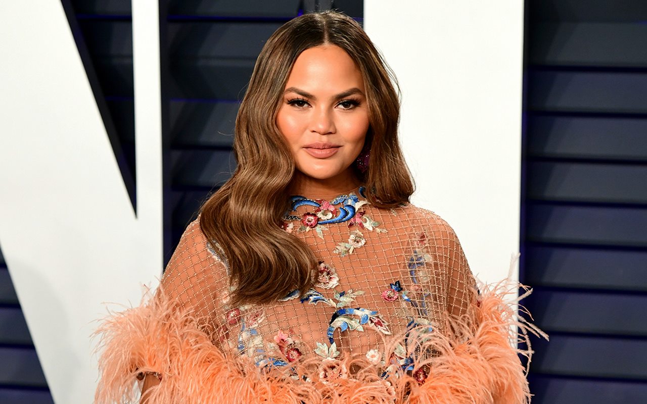 Chrissy Teigen Curhat Kehilangan Gigi Usai Pelantikan Joe Biden