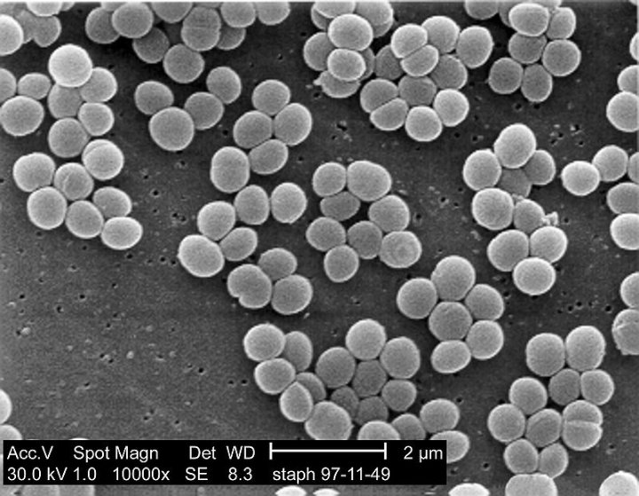 Coagulase Negative Staphylococci (CoNS)