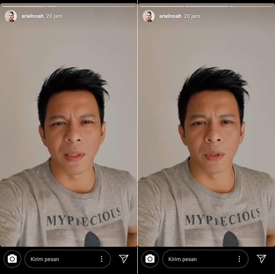 Usai Terima Vaksin Tahap 2, Ariel NOAH Dapat Tawaran Cek Antibodi