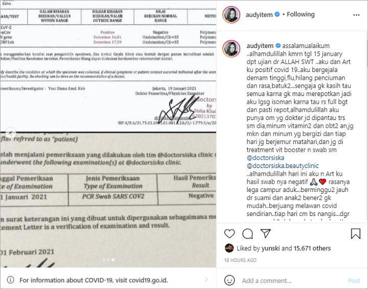 Audy Item Menangis Harus Berjuang Sendirian Lawan Covid-19, Ungkap Kondisinya Kini
