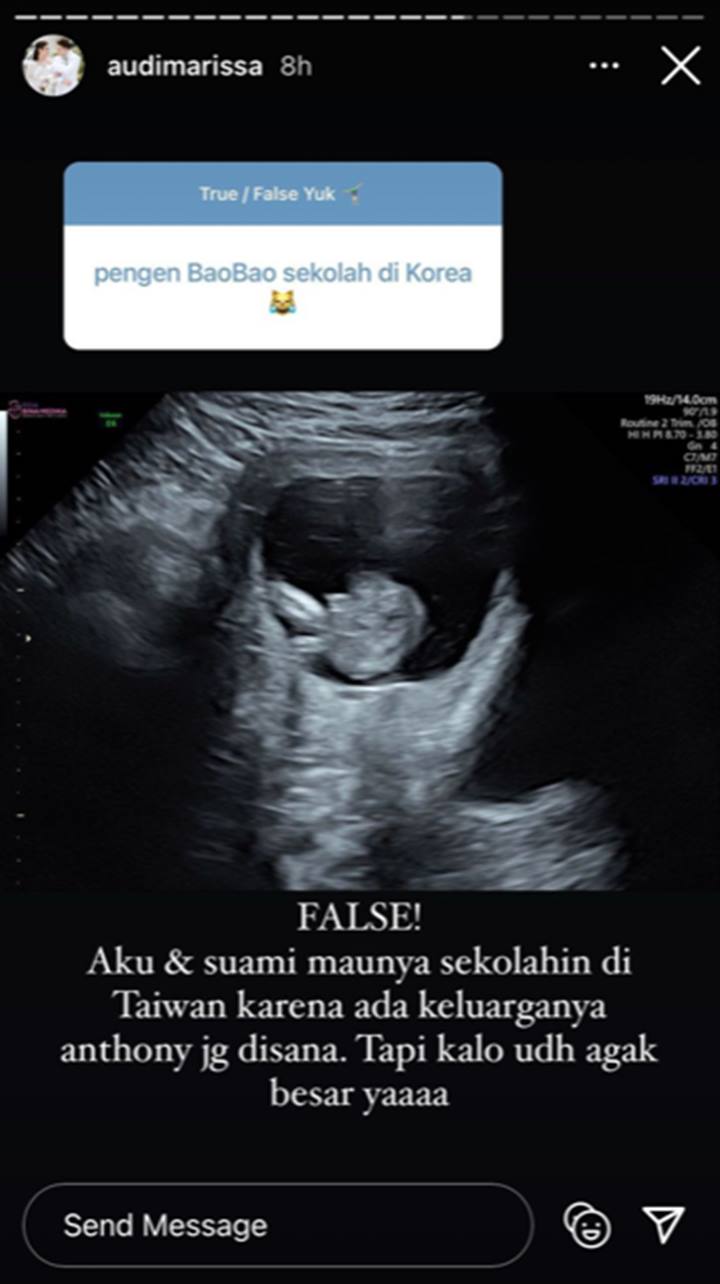 Belum Juga Lahir, Audi Marissa Gercep Pilihkan Tempat Sekolah Untuk Sang Anak