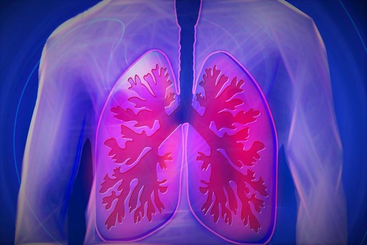Tuberkulosis