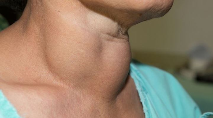 Bisa Jadi Bukan Menopause Ini 7 Penyakit Dengan Gejala Yang Sama