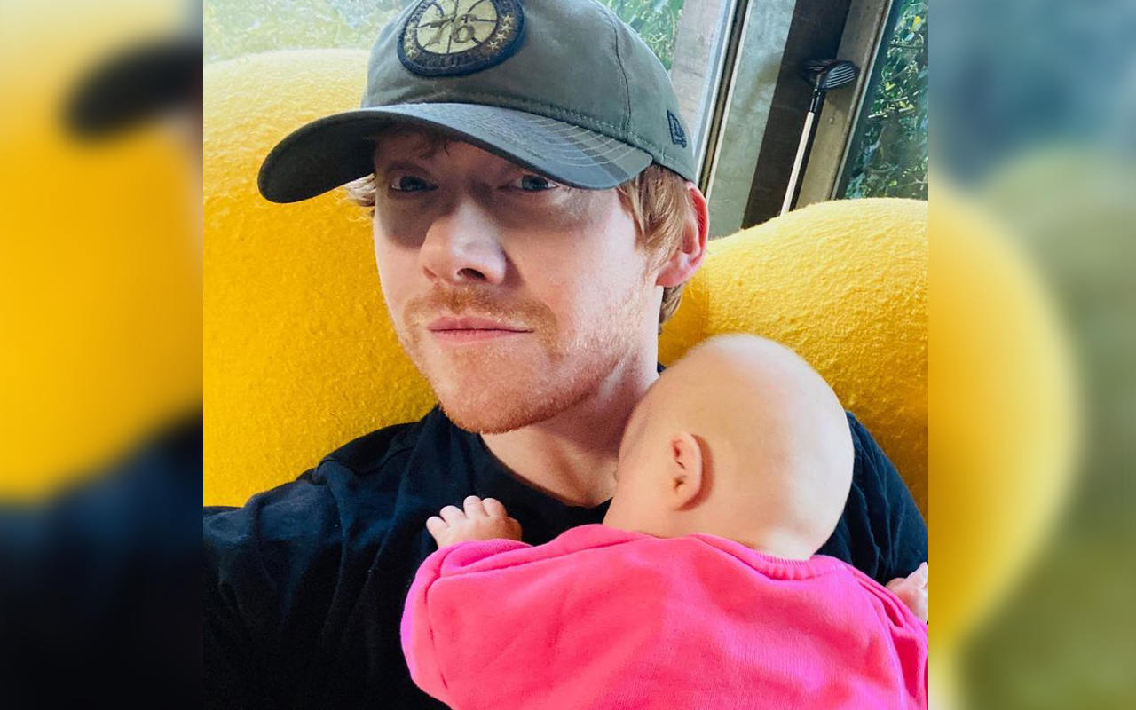 Rupert Grint Beri Pengakuan Mengejutkan Soal Syuting 'Harry Potter', Tak Selalu Menyenangkan