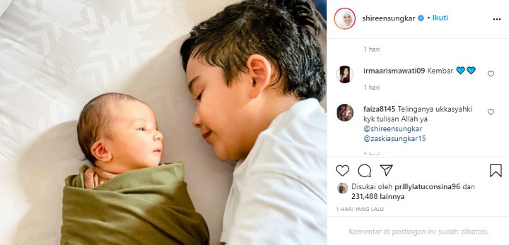 Telinga Putra Zaskia Sungkar-Irwansyah Jadi Sorotan, Disebut Ada Tulisan Mirip Lafadz Allah