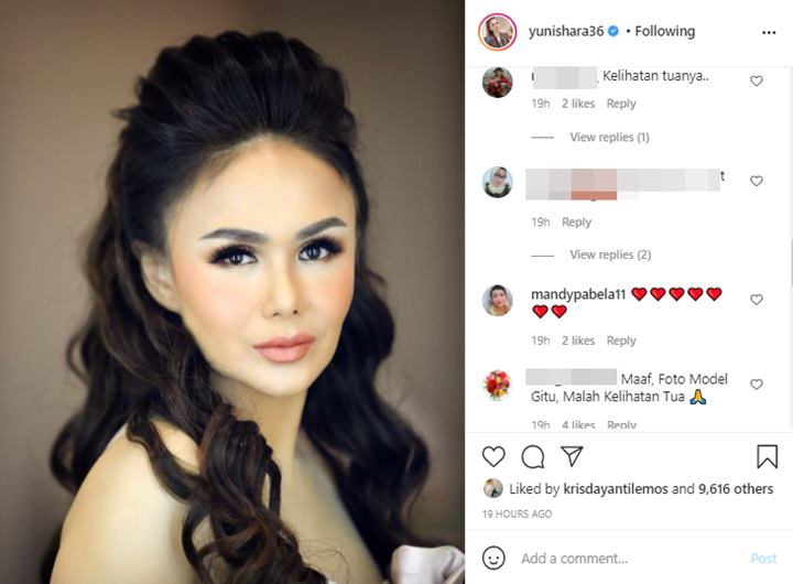 Biasa Dipuji Awet Muda, Yuni Shara Tuai Kritik Gara-gara Perubahan Wajah di Foto Terbaru