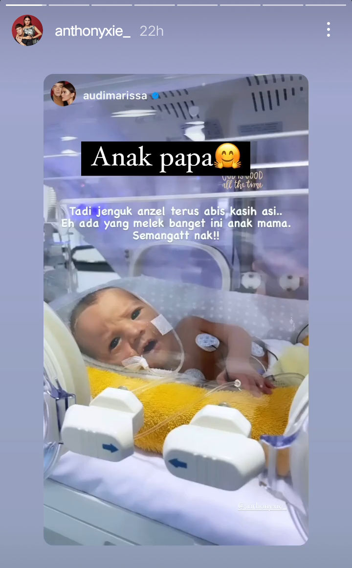 Audi Marissa dan Anthony Xie Pamer Foto Tampan Baby Anzel Buka Mata, Bule Banget