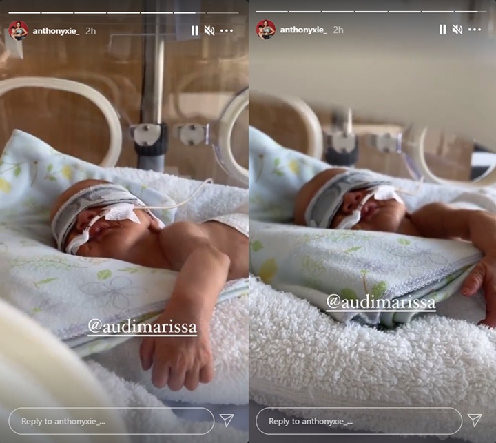 Audi Marissa dan Anthony Xie Pamer Foto Tampan Baby Anzel Buka Mata, Bule Banget