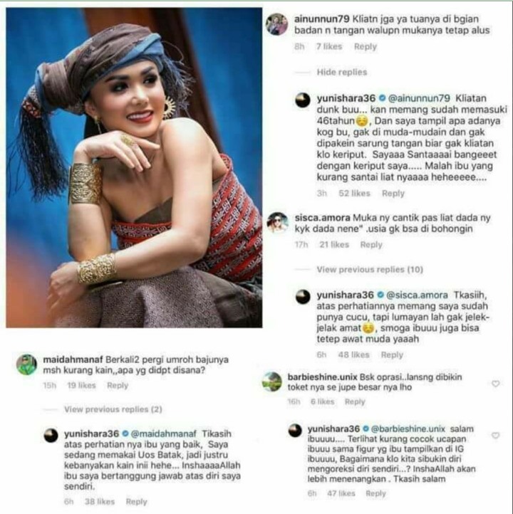 Yuni Shara Mendadak Jadi Trending Topik, Jawaban Bijak Saat Diledek Kriput Banjir Dukungan