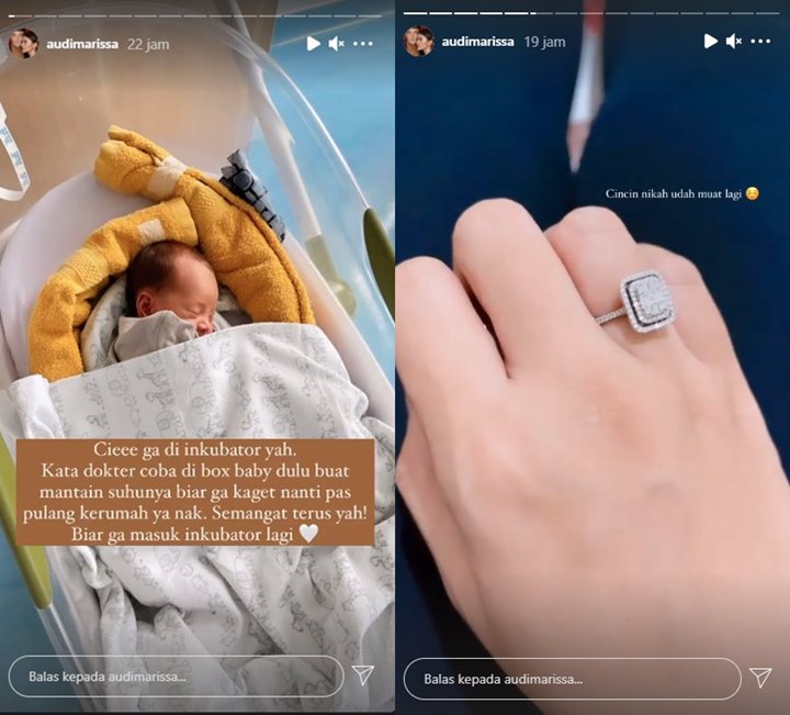Keluar dari Inkubator, Ini Alasan Bayi Audi Marissa Masih Minum ASI Pakai Dot