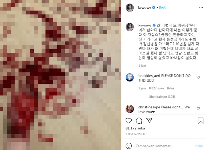 Mina Eks AOA Bagikan Postingan Percobaan Bunuh Diri
