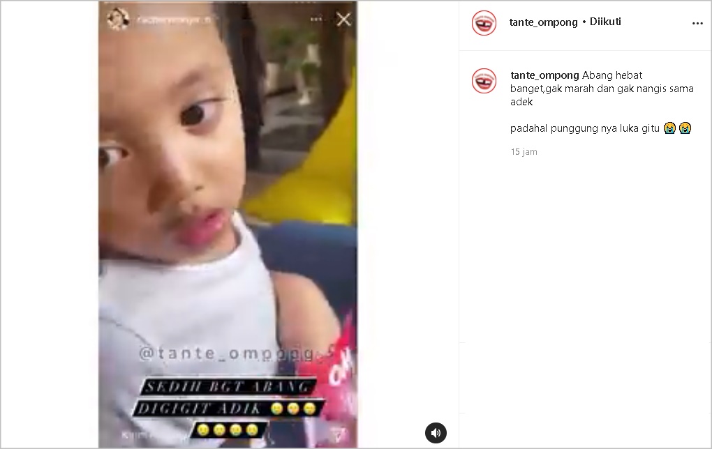Reaksi Xabiru Usai Digigit Sang Adik Sampai Terluka Bikin Kagum, Rachel Vennya Ikut Panen Pujian