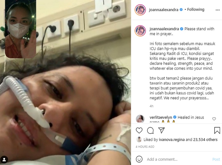 Kondisi Suami Joanna Alexandra Kritis di ICU