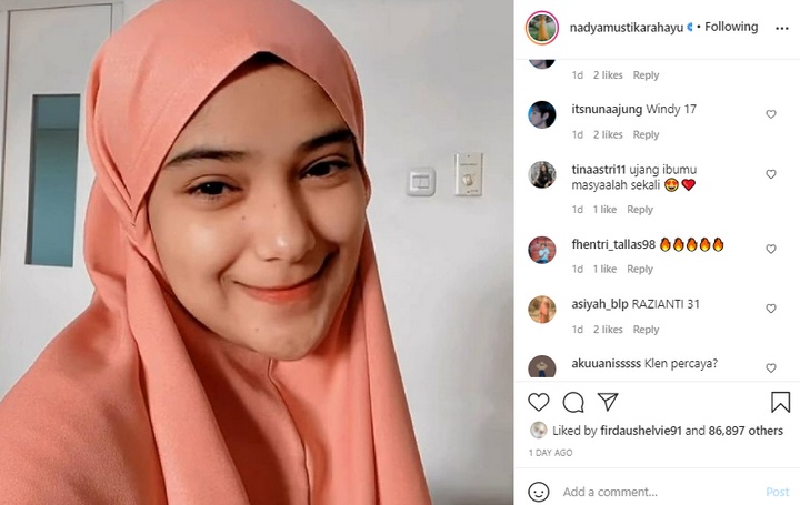 Wajah Pucat nadya Mustika rahayu Bikin Khawatir, Rizki DA Kemana?