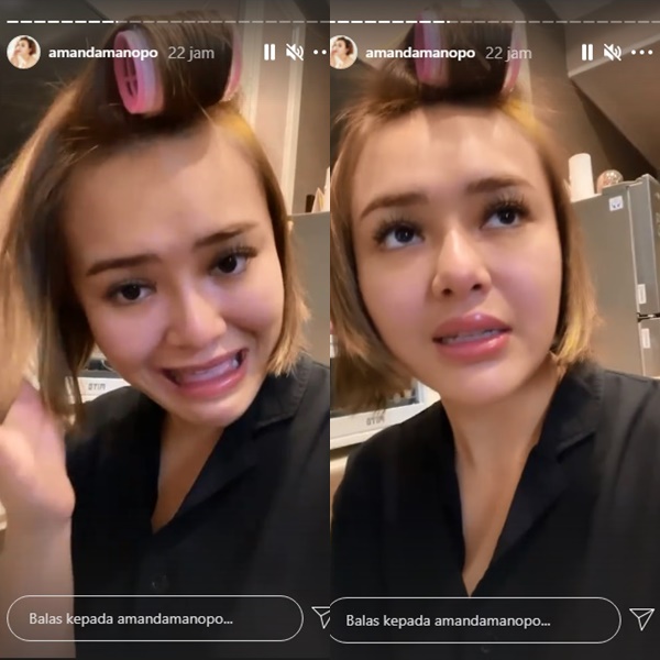 Susul Sang Kakak, Amanda Manopo Ikut Beri Penjelasan Usai Dituding Operasi Bibir
