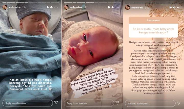 Audi Marissa Bawa Baby Anzel ke klinik Mata, Para Suster Malah Kaget Gara-gara Ini