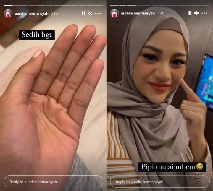 Aurel Hermansyah Sedih Rambut Rontok Di Tengah Kondisi Harus Bed Rest, Begini Potret Terkininya