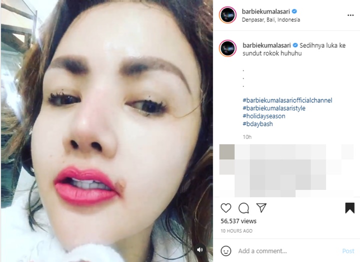 Bagikan Potret Bibir Tersulut Rokok, Barbie Kumalasari Kembali Panen Cibiran
